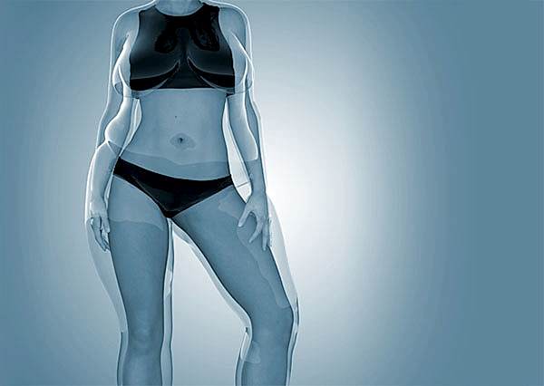 Post Bariatrik Cerrahi - 360 Body Lift